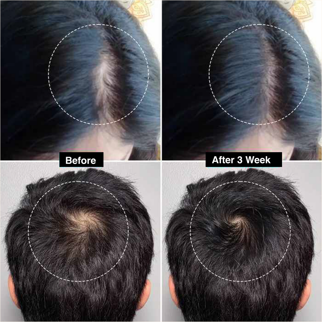 Neuron Hair Repair & Growth Serum 50ml | Keratin & Argan Oil |