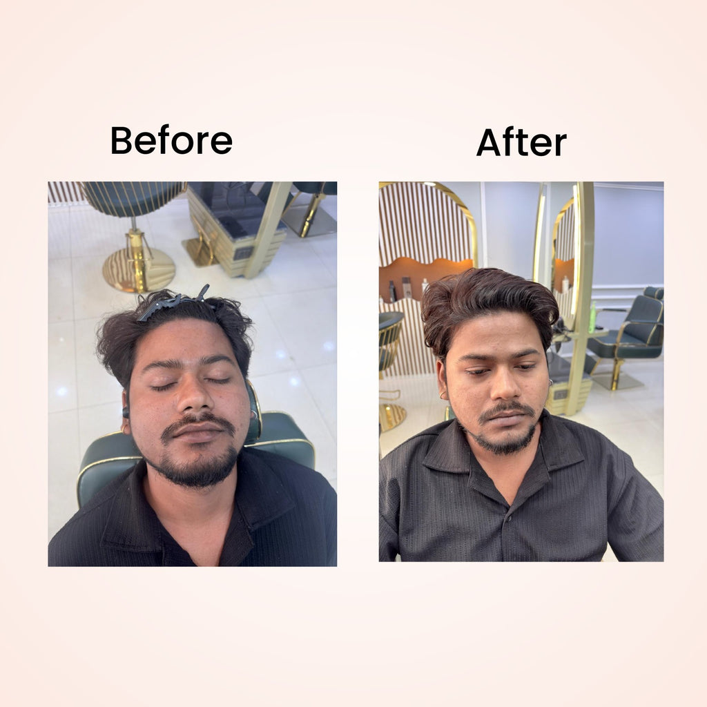 De-Tan Pack - 200 gram  (No Sun Only Moon)